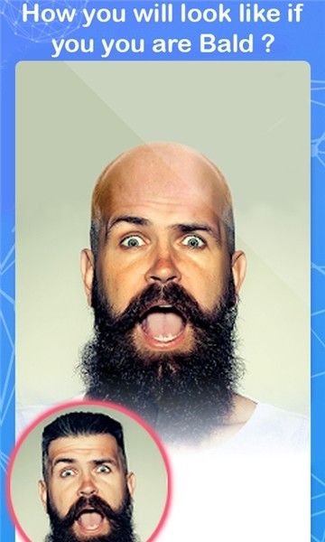 Bald