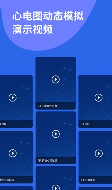 心电图ECG免费版v1.9截图4